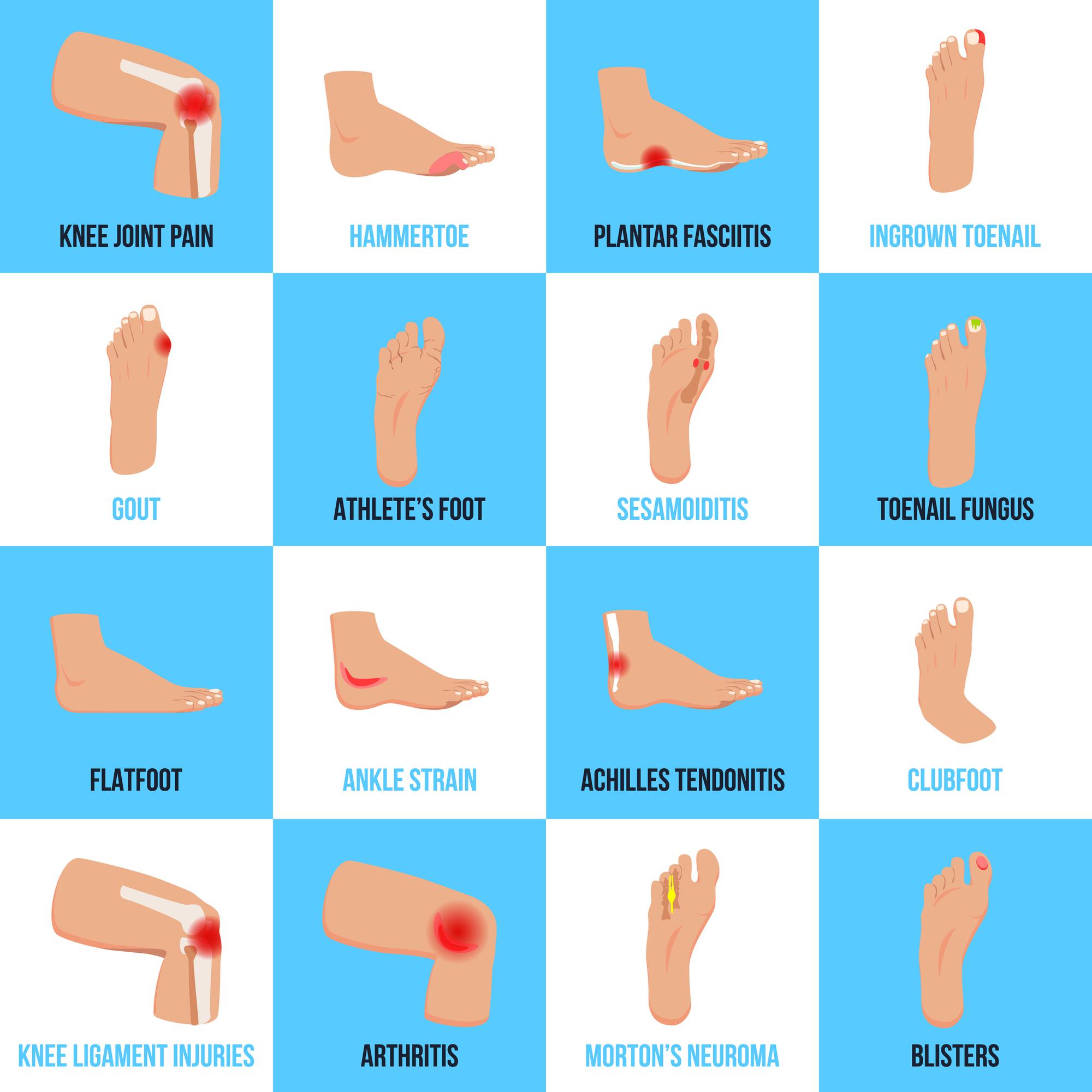 Foot Pain Causes & How to Fix It